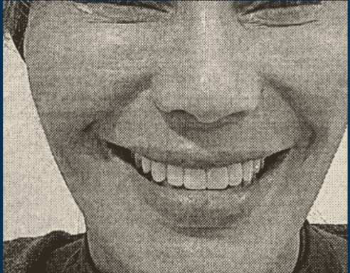 Close-up of smiling patient after cosmetic procedure by Dr. Michael BYUN.